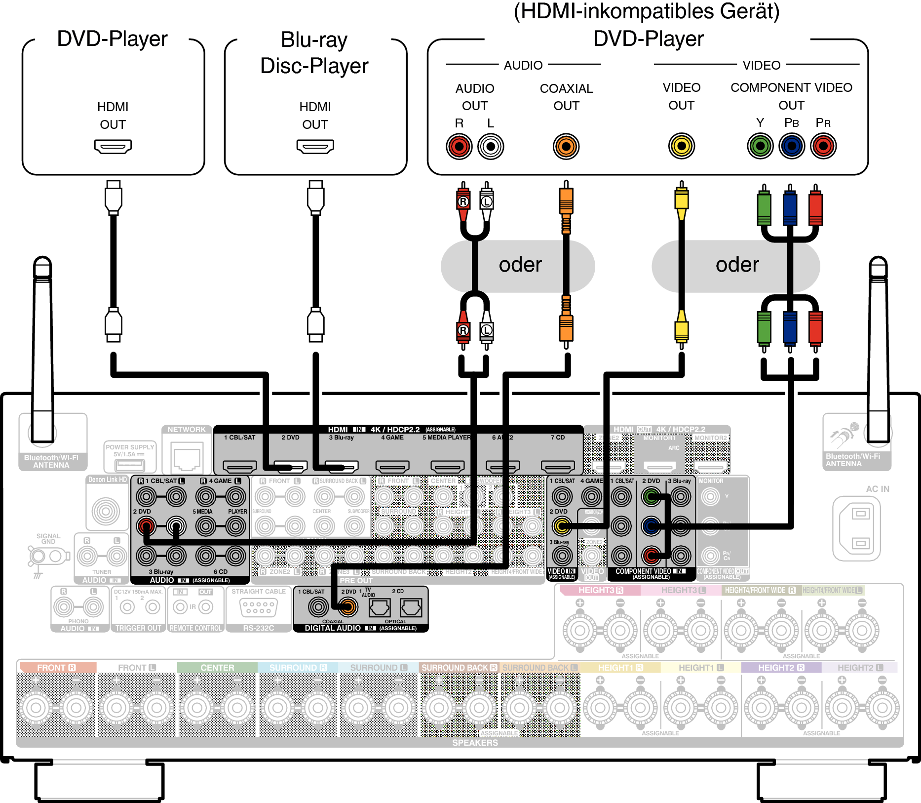 Conne DVD X85E2